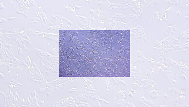 FOXR2_produzierende_Neuroblastom_Zellen__Schmitt_Hoffner_KiTZ.jpg Neuroblastom-Zellen