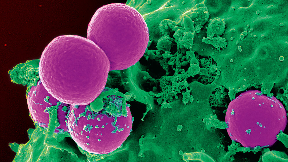 MRSA-Infektionen im Krankenhaus