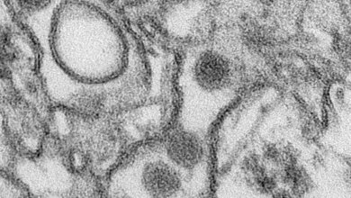 Zika_CDC_Cynthia_GoldsmithPublic_domain_via_Wikimedia_Commons_04032016.jpg Zika-Virus
