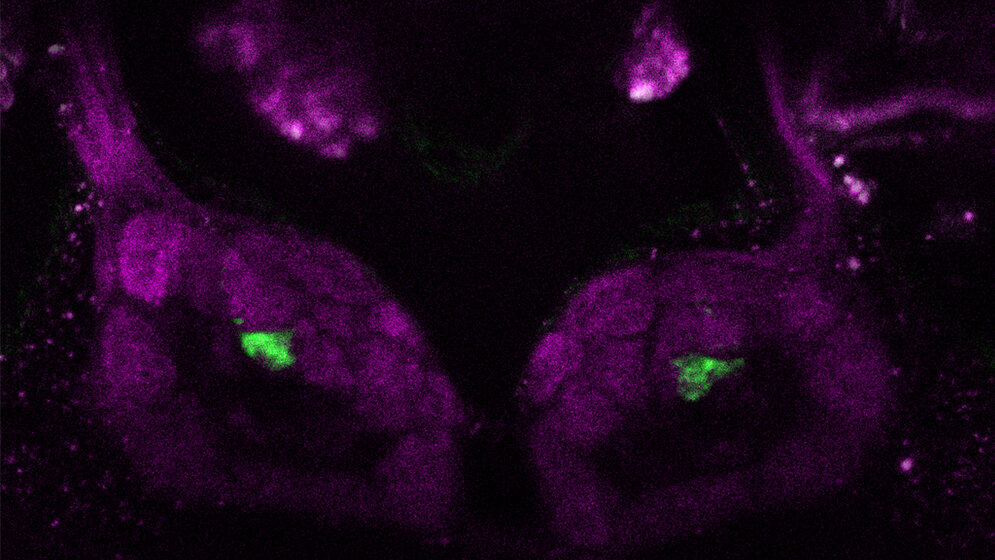 Fluoreszenzmikroskopische_Aufnahme_des_Antennallobus_Veit_Grabe_MPI_fuer_chemische_Oekologie.jpg Fluoreszenzmikroskopische Aufnahme des Antennallobus