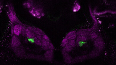Fluoreszenzmikroskopische Aufnahme des Antennallobus