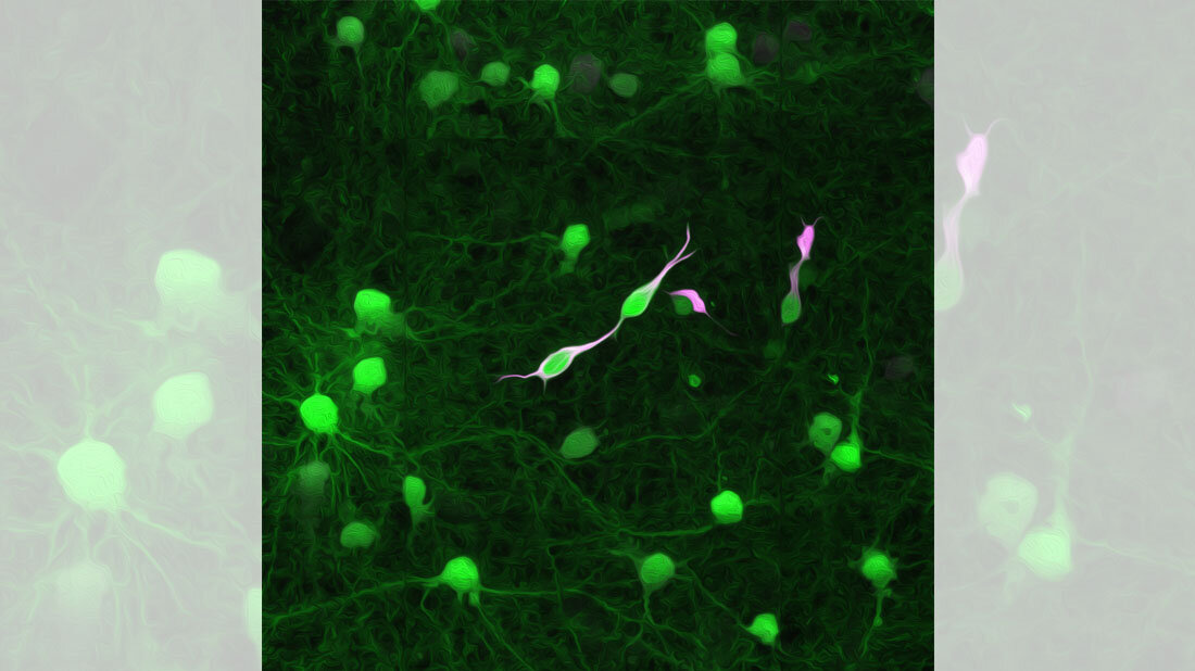 Glioblastom_Tollwutviren.jpg Stilisierte Darstellung von Tollwutvirus-infizierten Tumorzellen