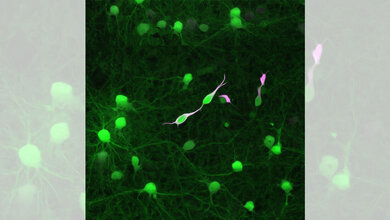 Stilisierte Darstellung von Tollwutvirus-infizierten Tumorzellen