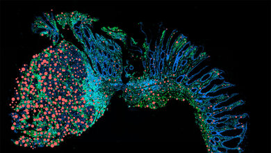 Entzündung Onkostatin M