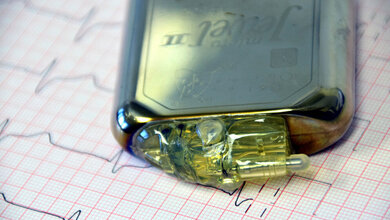 pacemaker-1943662_1920.jpg Medizinprodukte
