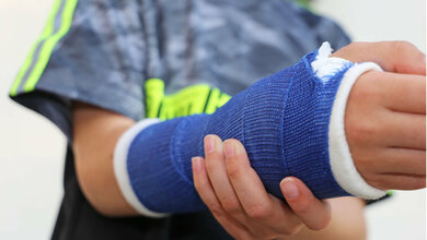 KI soll bei Frakturen unterstützen