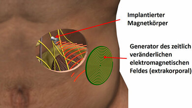 Prinzipskizze des Magnetoceuticals-Ansatzes