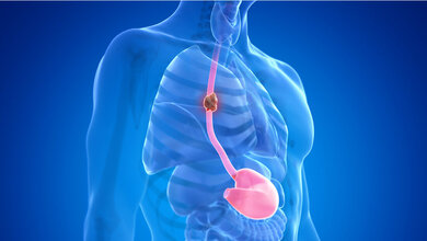 Studie zu Speiseröhrenkrebs