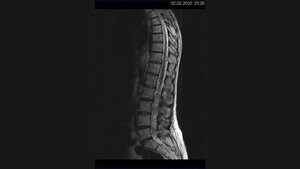 Schnittbilddiagnostik der Wirbelsäule (4.12)