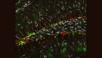 Neues Schlüsselprotein identifiziert, das die Nervenzellbildung im Gehirn reguliert. 