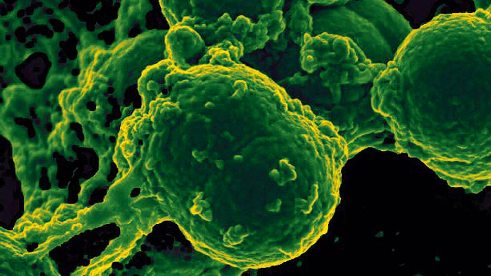 Studie Multiresistente Erreger