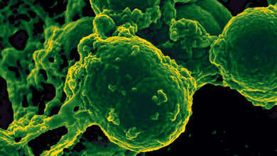 Multiresistente Erreger