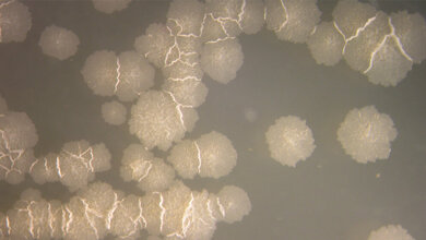 Tuberkulose_Bild_IMM_UZH_24062016.jpg Langsam wachsende Tuberkulose-Bakterien.