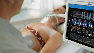 Neue PulmoVista-500-Software