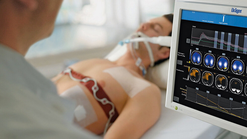 Neue PulmoVista-500-Software