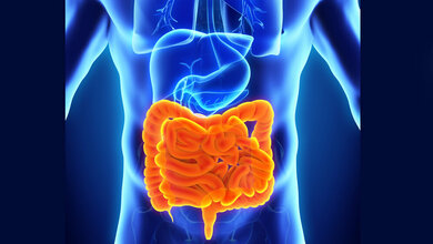 Darm_nerthuz_stock_adobe_com.jpg Verstärkte Entzündung Darmschleimhaut