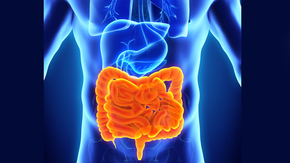 Verstärkte Entzündung Darmschleimhaut