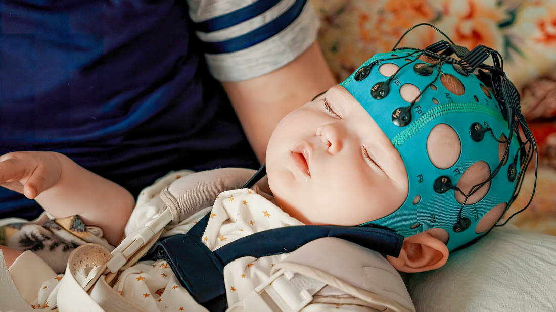 EEG_beim_Kind.jpg Kind, bei dem ein EEG gemacht wird.