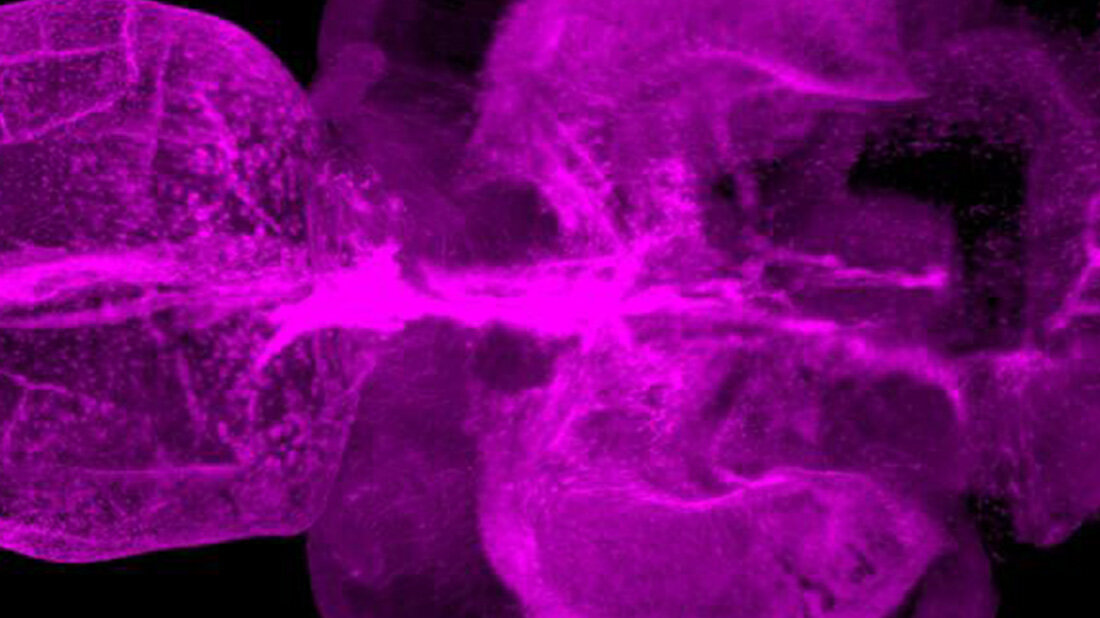 Regeneration des Gehirns verbessern, Schlüsselfaktoren im Zebrafischmodell identifiziert