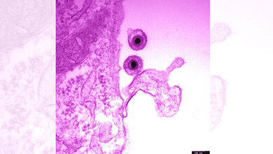 EHV_1_Herpesvirus_Azab_Walid.jpg EHV-1 / Herpesvirus