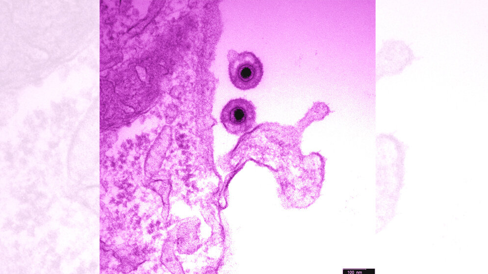 EHV_1_Herpesvirus_Azab_Walid.jpg EHV-1 / Herpesvirus