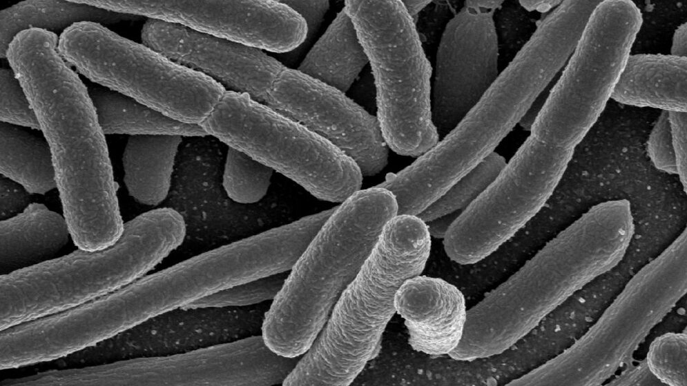 Escherichia_coli_Rasterelektronenmikroskopische_Aufnahme_Rocky_Mountain_Laboratories_NIAID_NIH_public_domain.jpg Escherichia coli