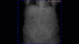 Schnittbilddiagnostik der Wirbelsäule (3.9)