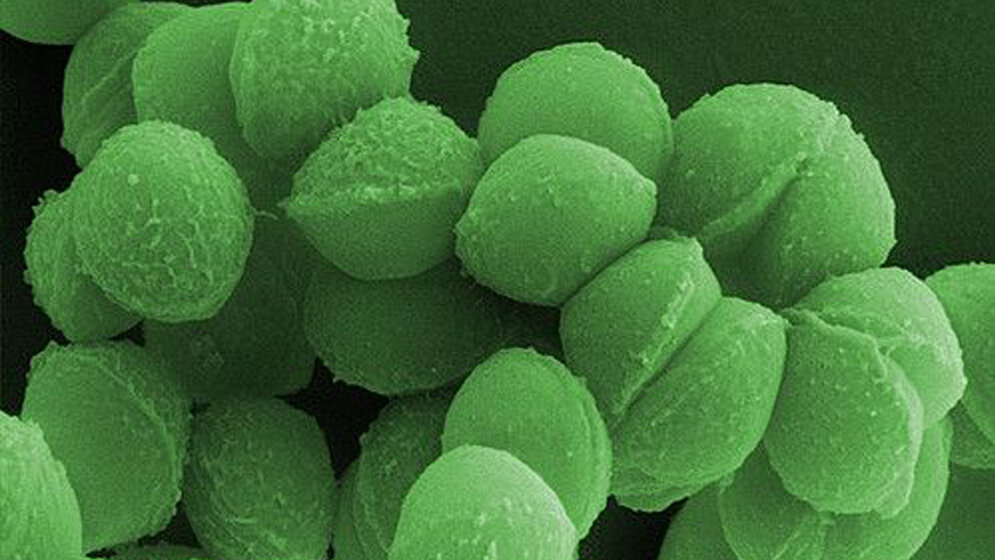 Streptococcus pyogenes 