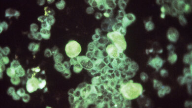 Mikrobiologie