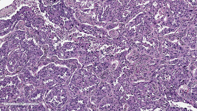 Optimierung und Validierung von PDL1-Färbeprotokollen am Beispiel E1L3N