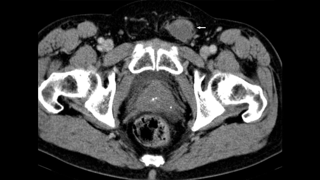 Titelbild des Fachbeitrags zur Bildgebung bei Maldescensus testis