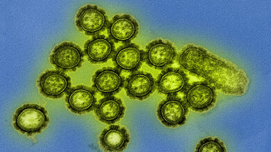 Viruspartikel des Grippeerregers H1N1 