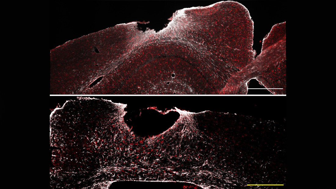 Bild von Wundheilung bei Schädel-Hirn-Trauma.