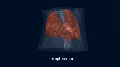 Phasenkontrast-Bildgebung 