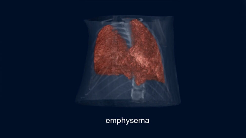 Phasenkontrast-Bildgebung 