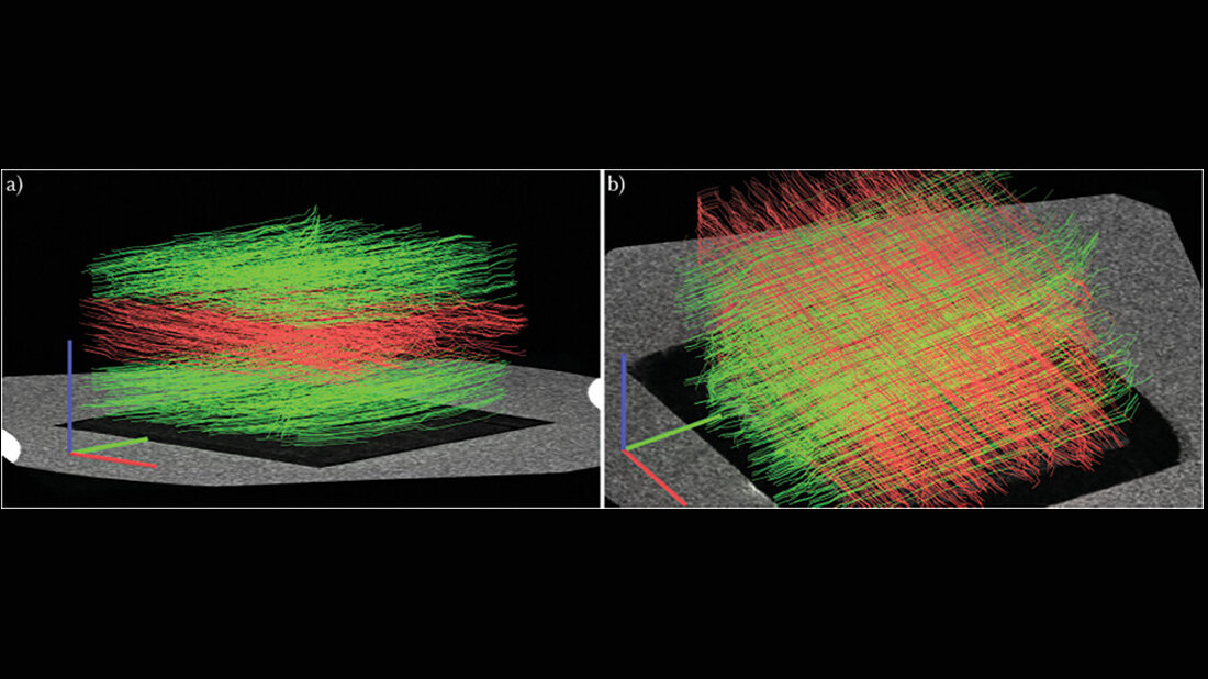 Gehirnphantom.jpg Gehirnphantom