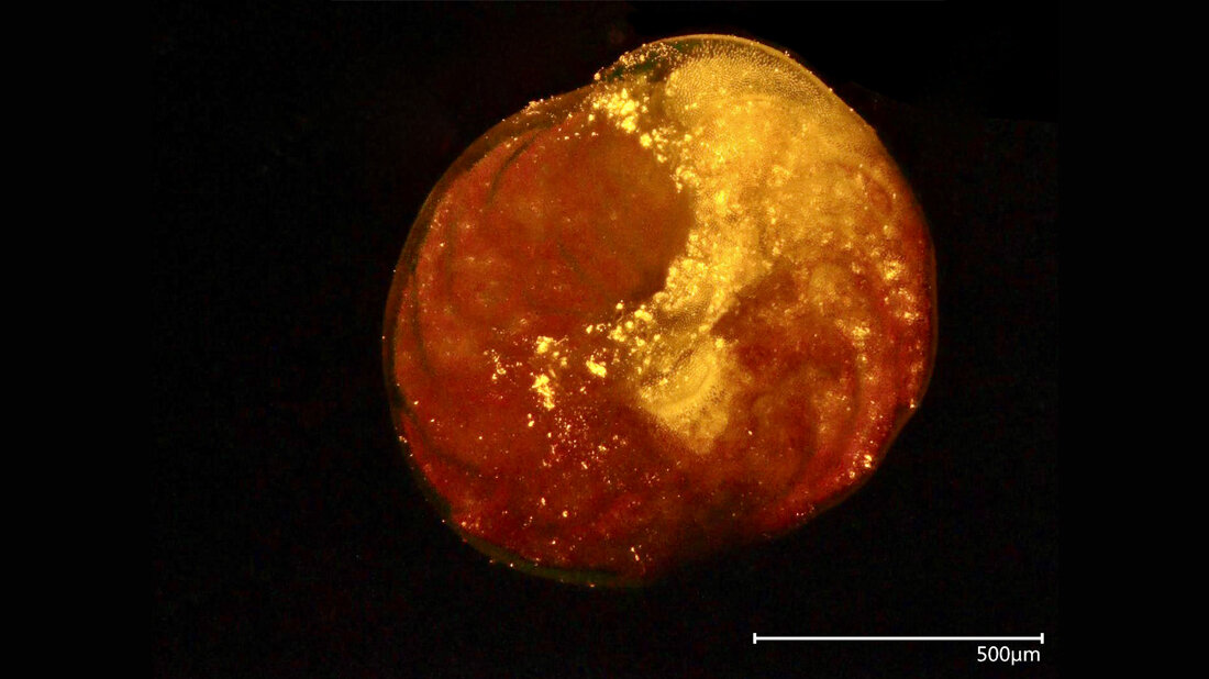 Mikroplastik_01.jpg Foraminifere mit Nanoplastik