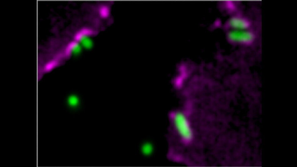 PseudomonasaeruginosaInfektion Welche Rolle spielen Septine? MTDialog