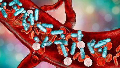 340.000 Sepsistote jährlich