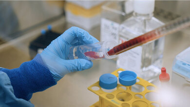 Blutproben von Hepatitis-C-Patientinnen und -Patienten.