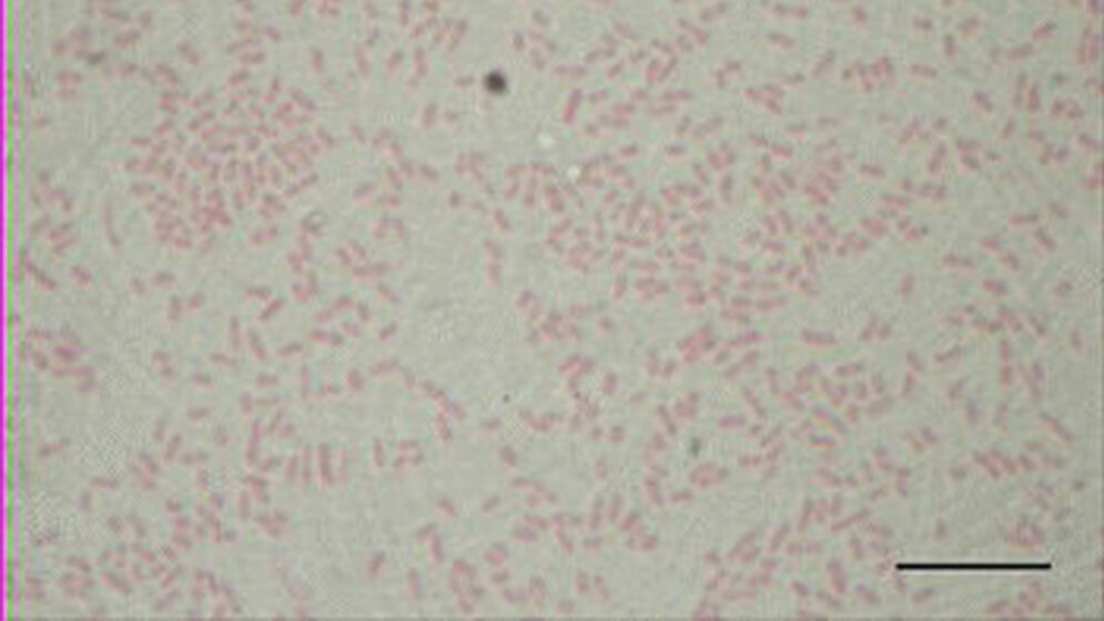 Wohlfahrtiimonas chitiniclastica – ein Fallbeispiel Labordiagnostik