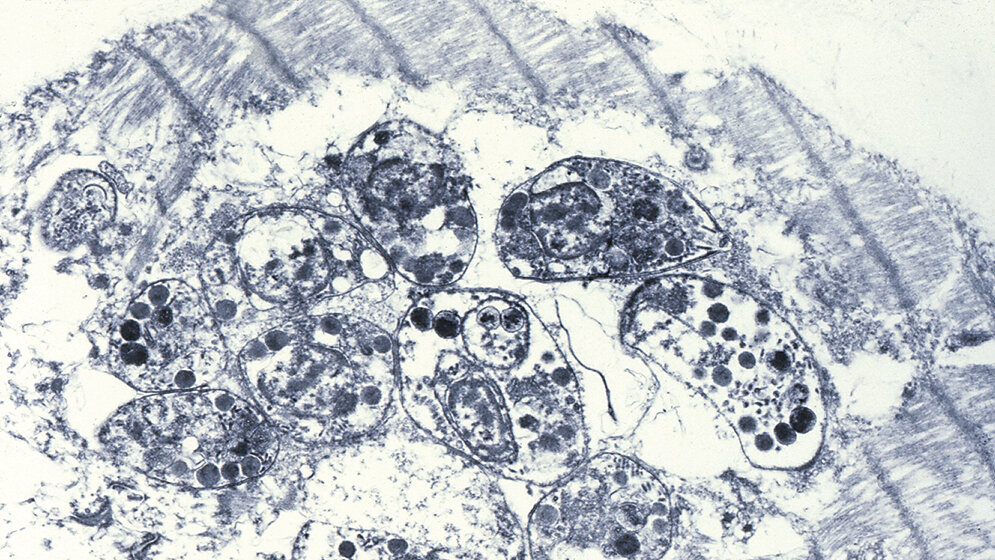 Zytologie Toxoplasmose