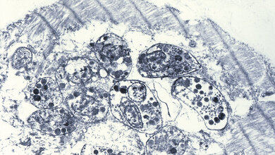 Zytologie Toxoplasmose