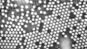 Poliovirus