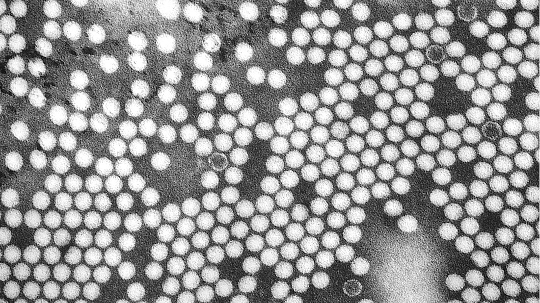 Titelbild.jpg Poliovirus