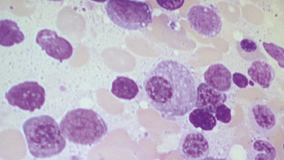 7. Offenburger Hämatologietage