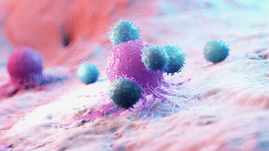 Immunzellen_Hirntumor.jpg Immuntherapien versagen bei bösartigen Hirntumoren, warum?