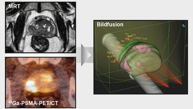 Bildgebungsmethoden mit Echtzeit-Ultraschallbild fusioniert