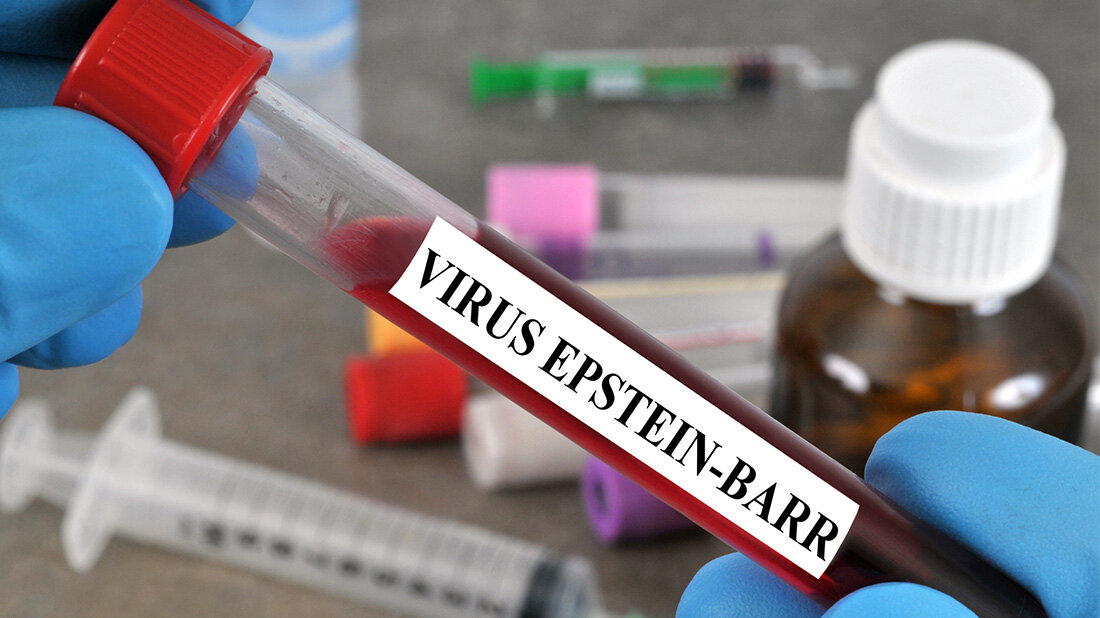 EBV-Infektionen.jpg Schwere EBV-Infektionen mit individueller Immuntherapie behandeln