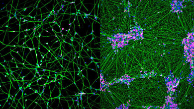 Menschliche Nervenzellen in verschiedenen Reifestadien